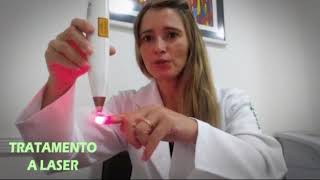 MICOSE DE UNHA  TRATAMENTO A LASER [upl. by Loren81]