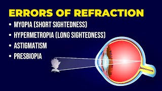 Errors of Refraction  Myopia  Hypermetropia  Astigmatism  Presbiopia  Short amp Long Sightedness [upl. by Millda]