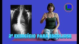 ESCOLIOSE  EXERCÍCIOS SIMPLES QUE FUNCIONAM  PARTE 2 [upl. by Dorison]