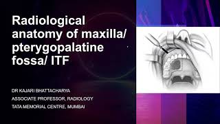 Radiological anatomy of maxillapterygopalatine fossa infratemporal fossa  Dr Kajari Bhattacharya [upl. by Hanley]