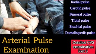 Pulse Examination  CVS examination part 5 [upl. by Vanzant607]