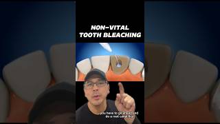 Procedural Steps for NonVital Tooth Bleaching  In Office to Hands On Dental Training shorts [upl. by Nolitta]