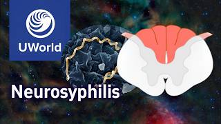 Syphilis Neurosyphilis amp Tabes Dorsalis SymptomsPathophysiology UWorld Step 1 [upl. by Annairam633]