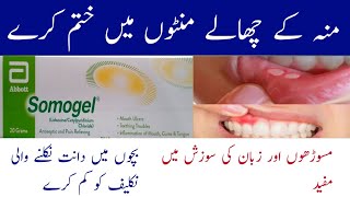 somogel for mouth ulcers  somogel  sumo gel  somogel lagane ka tarika  mouth ulcer treatment [upl. by Kala]