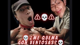 ⚠️🔥¿QUEMARÉ a mi COMPA Usando VENTOSAS por PRIMERA VEZ en ESPALDA 🔥⚠️ [upl. by Amathiste]