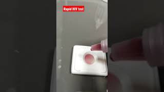 HIV Rapid Test Negative lab technician sample reagents viralshorts [upl. by Ludlow]