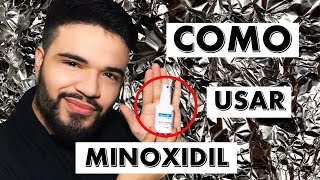 DICAS PARA USAR O MINOXIDIL  dúvidas mais frequentes [upl. by Tubb]