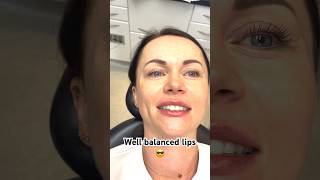 Directly after 05ml of lip filler [upl. by Mandel]