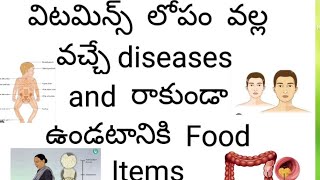 Diseases caused by vitamin deficiency [upl. by Notwal]