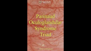 Parinaud Oculoglandular Syndrome Triad [upl. by Westney]