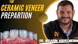 Ceramic veneer preparation  Dr Ibrahim Abdelmunim [upl. by Yve827]