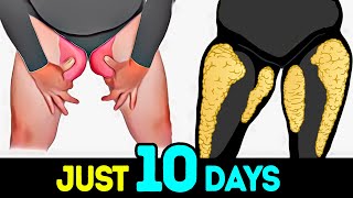 LOSE INNER THIGH FAT  OUTER THIGH FAT  10 DAYS CHALLENGE [upl. by Anabelle459]