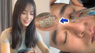 💈ASMR  Remove a lot of dead skin from a mans face with a rare razor 🪒 Oriental wet shave [upl. by Naillik133]