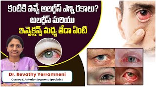 Conjunctivitis Causes Symptoms and Treatment  Types of Eye Infections  Smart Vision Eye Hospital [upl. by Nadbus]