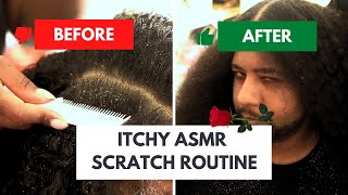 ASMR Scalp Flake Removal Routine Session for Soothing Relief [upl. by Aisined877]