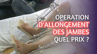 Opération chirurgical dallongement des jambes combien ça coute [upl. by Hayimas544]