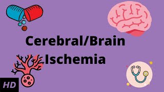 CerebralBrain Ischemia Causes Signs and Symptoms Diagnosis and Treatment [upl. by Avle543]