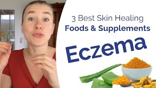 Eczema Treatment  The 3 Best Foods amp Supplements to Boost Your Skin Healing [upl. by Gurtner]