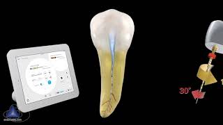 WaveOne® Gold Glider with Dr Cliff Ruddle  Dentsply Sirona [upl. by Bouton]