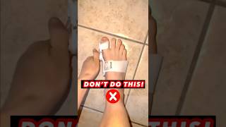 FIX YOUR BUNION THE NATURAL WAY 🤩🤩🤩 bunions bunion viralshorts [upl. by Black576]