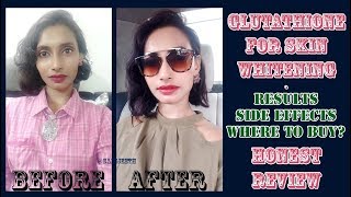 Glutathione Skin Whitening Tablets Results  Genuine Customer Review  SahiJeeth [upl. by Baer]