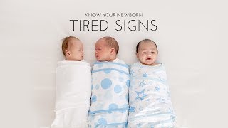 Baby Tired Signs [upl. by Shelba]