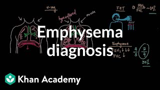 Emphysema diagnosis  Respiratory system diseases  NCLEXRN  Khan Academy [upl. by Apicella]