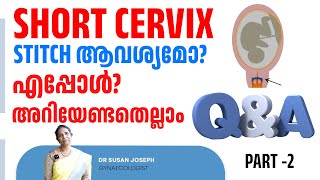 Short cervix  എപ്പോഴും stitch ആവശ്യമുണ്ടോ [upl. by Deehan]