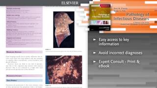 Pathology of Infectious Diseases [upl. by Barclay]