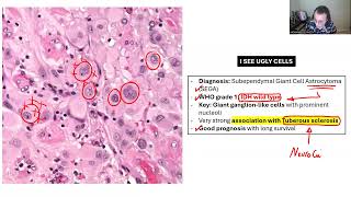 NEUROPATHOLOGY BOARD REVIEW 2 [upl. by Hinch]