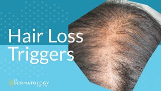 Common Hair Loss Triggers [upl. by Eliak]