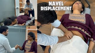 Dr Harish Grover Reveals Navel Displacement Cure [upl. by Inalaehon808]