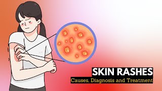 Skin Rash Causes Signs and Symptoms Diagnosis and Treatment [upl. by Aniri]