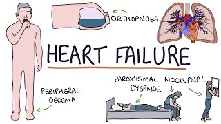 Understanding Heart Failure Visual Explanation for Students [upl. by Gallagher]