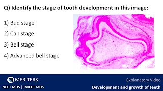 NEET MDS  INICET  Dental Histology  Stages of Tooth Development  Explanatory Video  MERITERS [upl. by Eicnan]