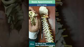 What is C1C2 instability instability Cervical Spine Surgeon in India  Spine Doctor in Gurgaon [upl. by Naira]