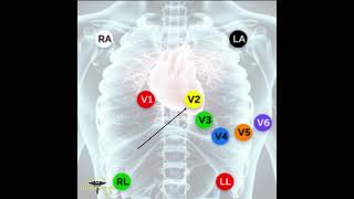 ECG PLACEMENT  12 LEAD ECG [upl. by Jara612]