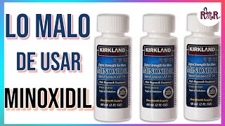 LO QUE NO SABES DE MINOXIDIL AL 5 ANTES Y DESPUÉS  CALVICIE ALOPECIArecuperandomisrizos [upl. by Htessil]