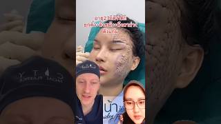 facialplasticsurgeon beauty facialplasticsurgery atlantafacialplasticsurgeon facialist [upl. by Yenahpets]