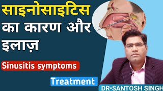 What are Sinusitis Symptoms and Treatment Explained in hindi  साइनोसाइटिस Ka Karan [upl. by Drabeck]