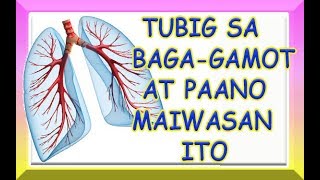 TUBIG SA BAGA PULMONARY EDEMA  GAMOT AT PAANO MAIWASAN [upl. by Vokaay]