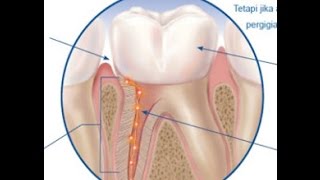 INILAH Tips Menghilangkan Gigi Ngilu Secara Permnen [upl. by Jaymie]