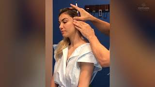 Ponytail Micro Lift Procedure by Dr Miller [upl. by Kyriako]