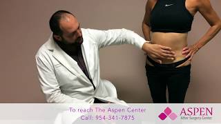 Liposuction Contour Irregularity  Stubborn Lipo Lumps and Bumps [upl. by Paulette999]