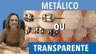 Diferença entre aparelho metal e transparente [upl. by Linet]