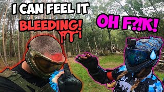 WTF HAPPENED TO HIS HEAD🤕😱► Paintball Shenanigans Part 108 [upl. by Meeki]