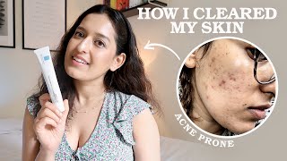 My 3 Step EvidenceBased Skincare Routine As A Doctor  HOW I CLEARED MY ACNE  Affordable Easy [upl. by Alikahs]