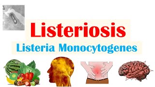 Listeriosis Listeria Monocytogenes  Sources Pathophysiology Symptoms Diagnosis Treatment [upl. by Yoccm]