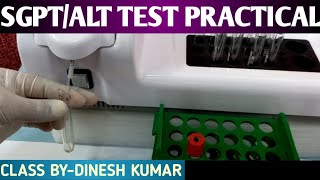 SGPT  ALT Test Practical video  LFT TEST Practical video in Hindi [upl. by Glennie]