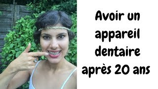 Avoir un appareil dentaire après 20 ans amp partage dastuces naturelles antidouleurs [upl. by Halet697]